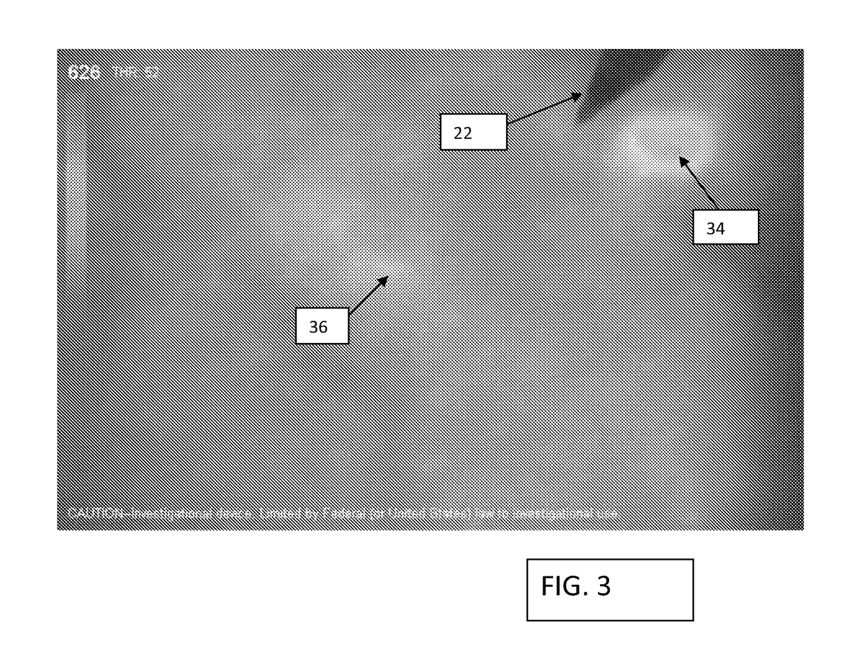 Locating and analyzing perforator flaps for plastic and reconstructive surgery