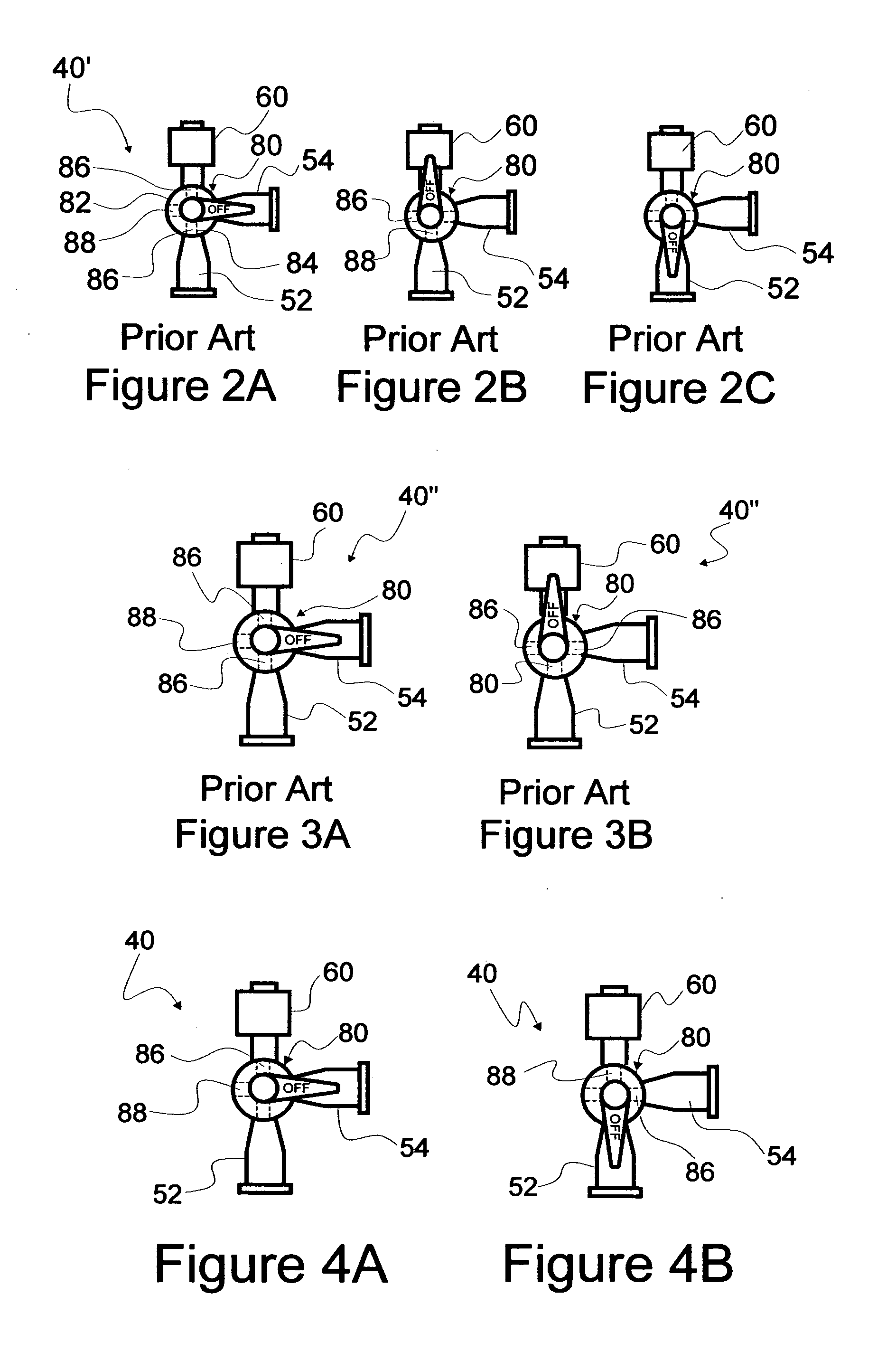 Convenience IV kits and methods of use