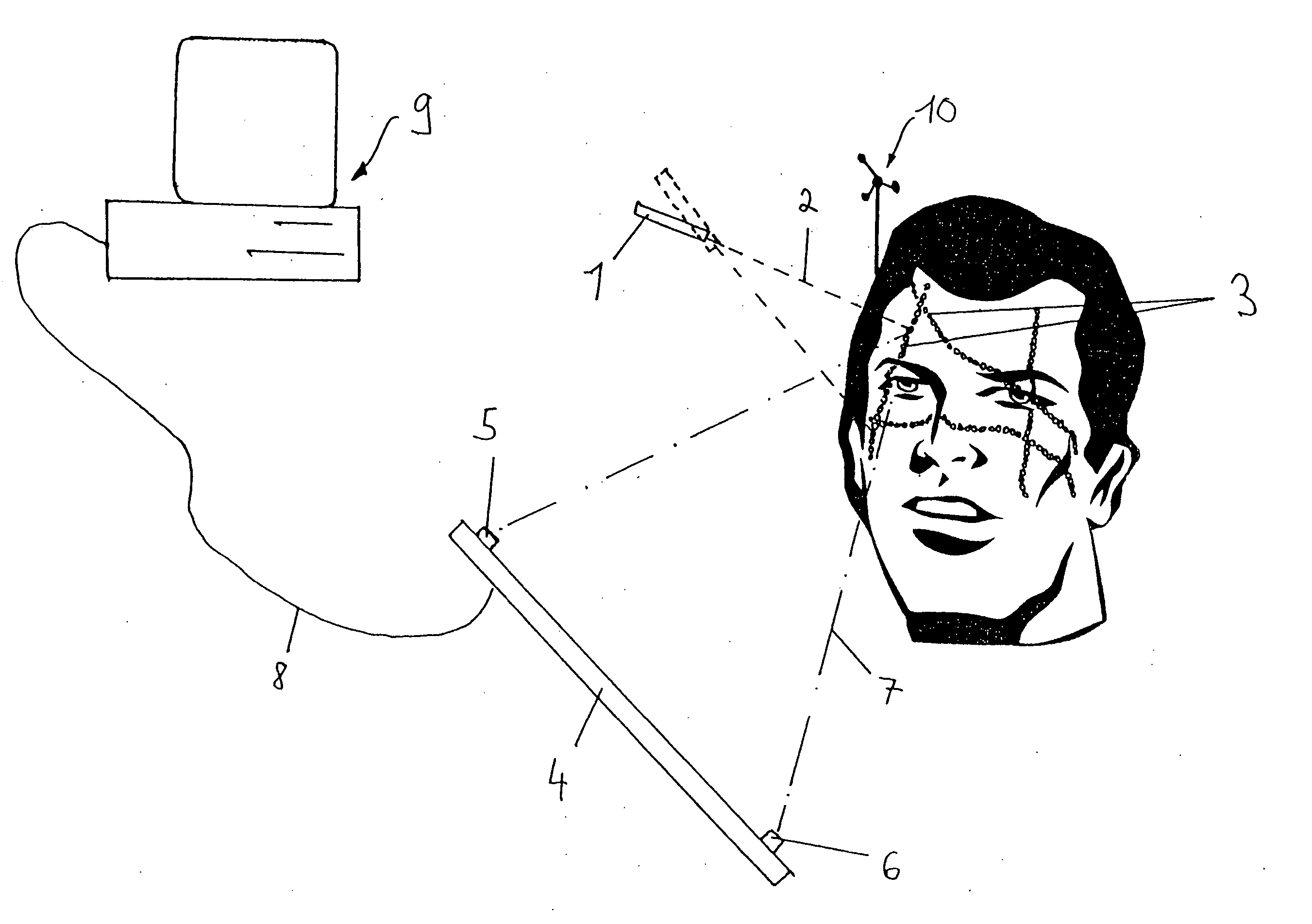 Referencing or registering a patient or a patient body part in a medical navigation system by means of irradiation of light points