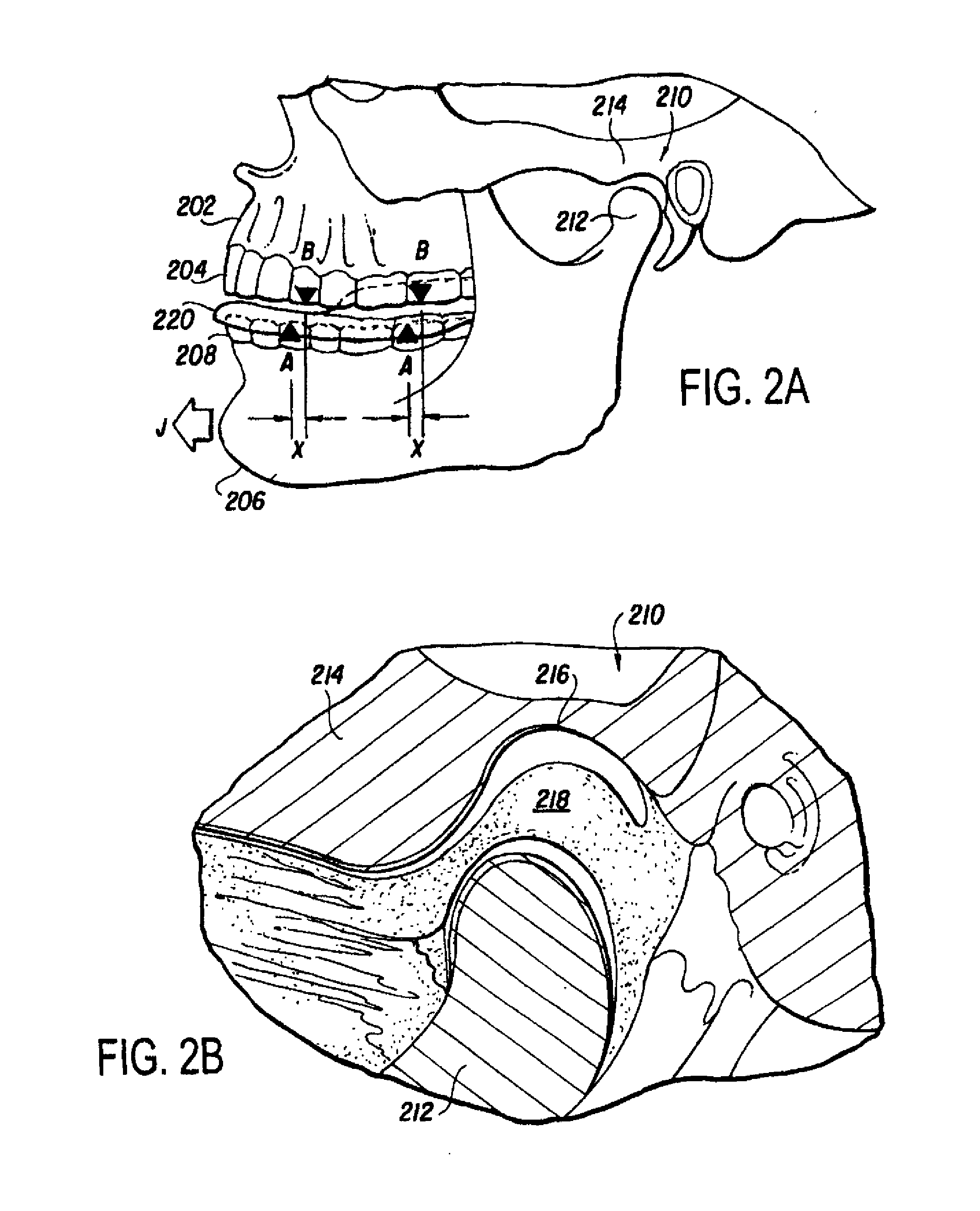 Physical rehabilitation and training aid: method of using musculoskeletal repositioning device