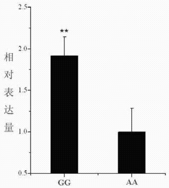 SNP molecular marker related to pig carcass trait and application thereof