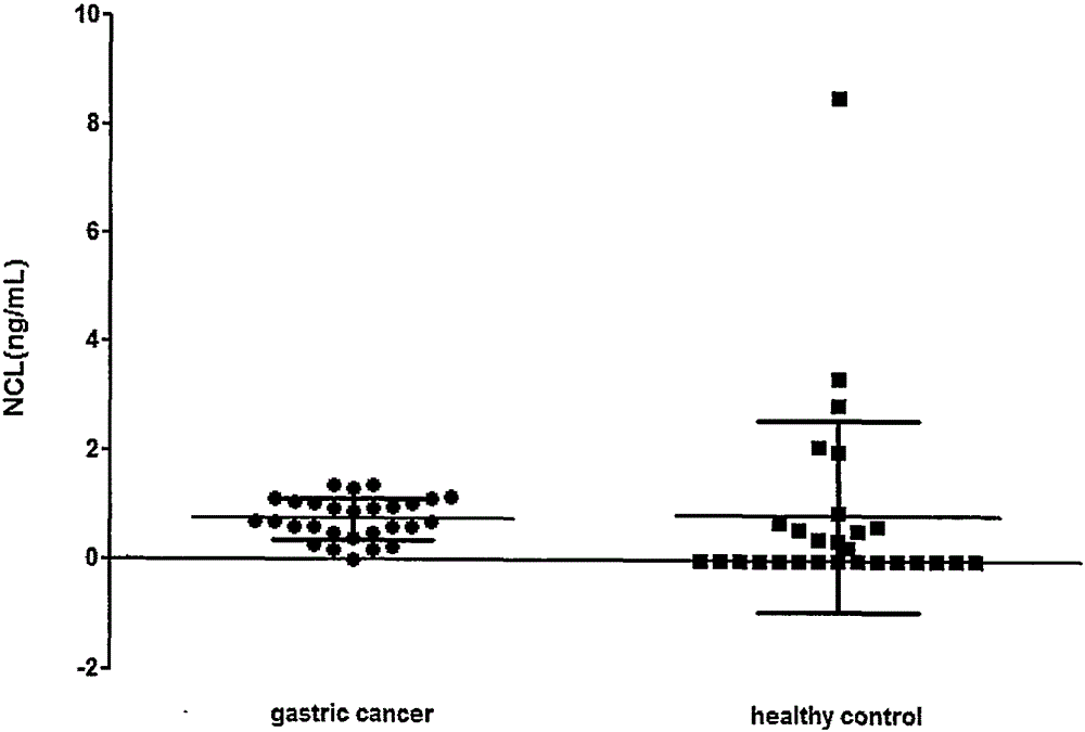 Application of nucleolin to preparation of diagnostic reagent and therapeutic for gastric cancer