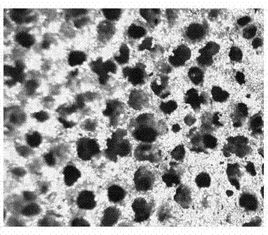 Method for preparing porous tantalum medical implant material