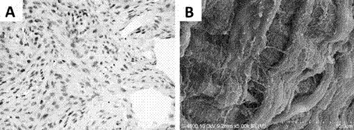 Preparation method of engineering periodontium