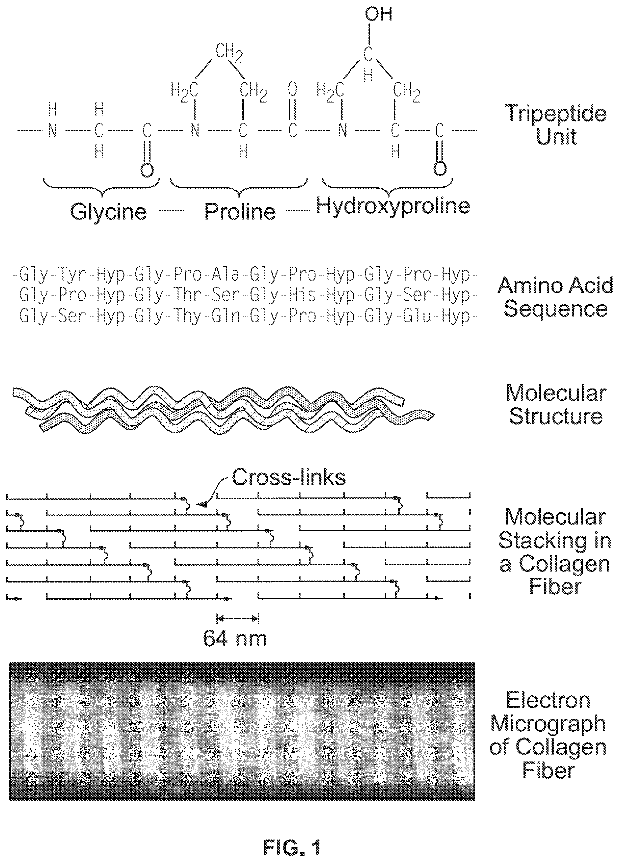 Material for bone implants and method of producing same