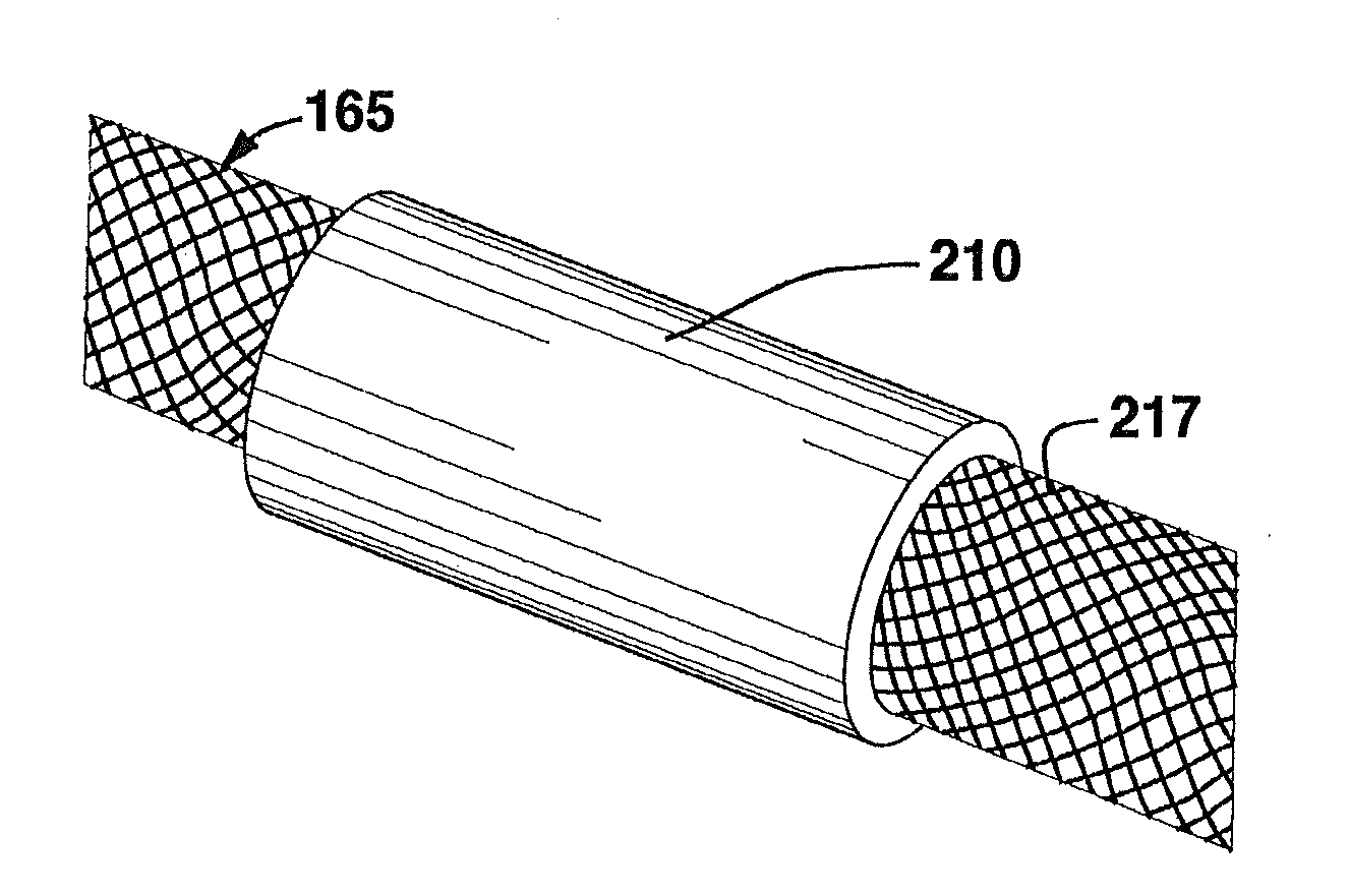 Compliant Blood Vessel Graft