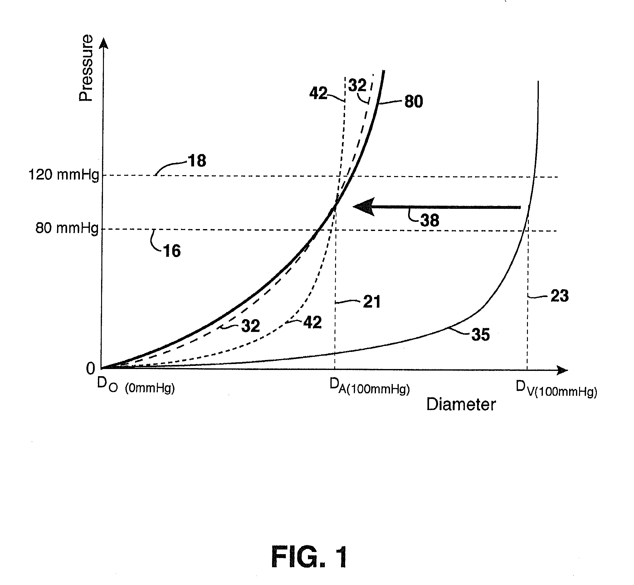 Compliant Blood Vessel Graft