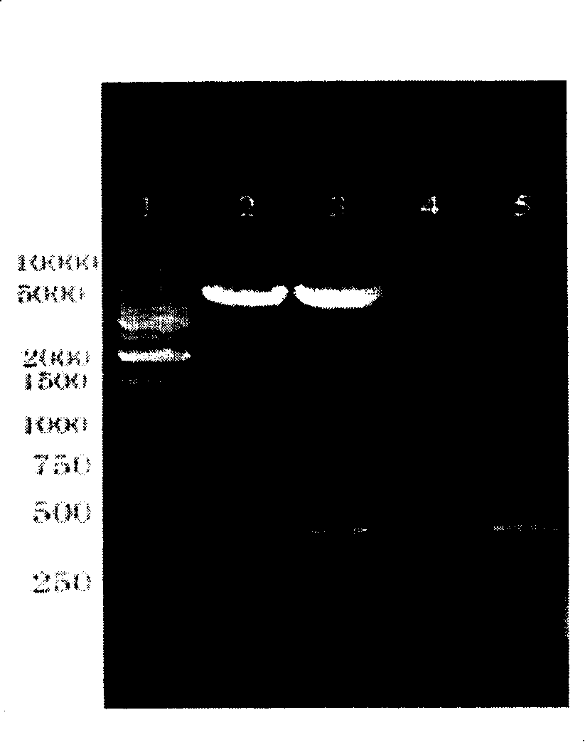 Blood vessel growth hormone gene recombined gland relative vrius carrier and its preparation process and application thereof