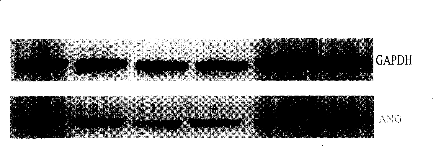 Blood vessel growth hormone gene recombined gland relative vrius carrier and its preparation process and application thereof