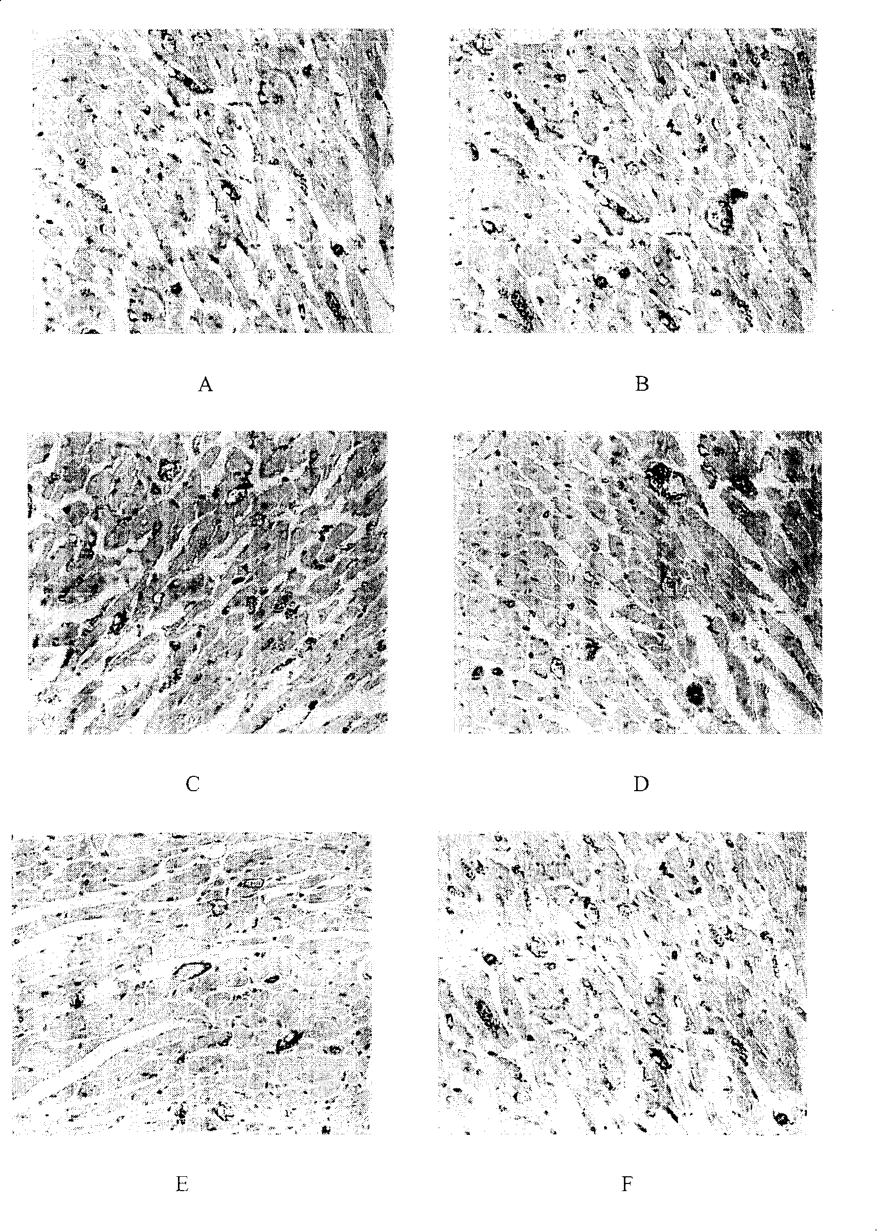 Blood vessel growth hormone gene recombined gland relative vrius carrier and its preparation process and application thereof