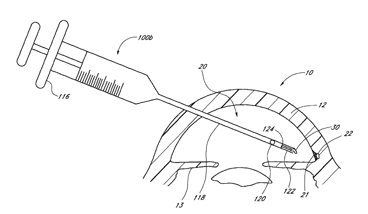 Implants with controlled drug delivery features and methods of using same