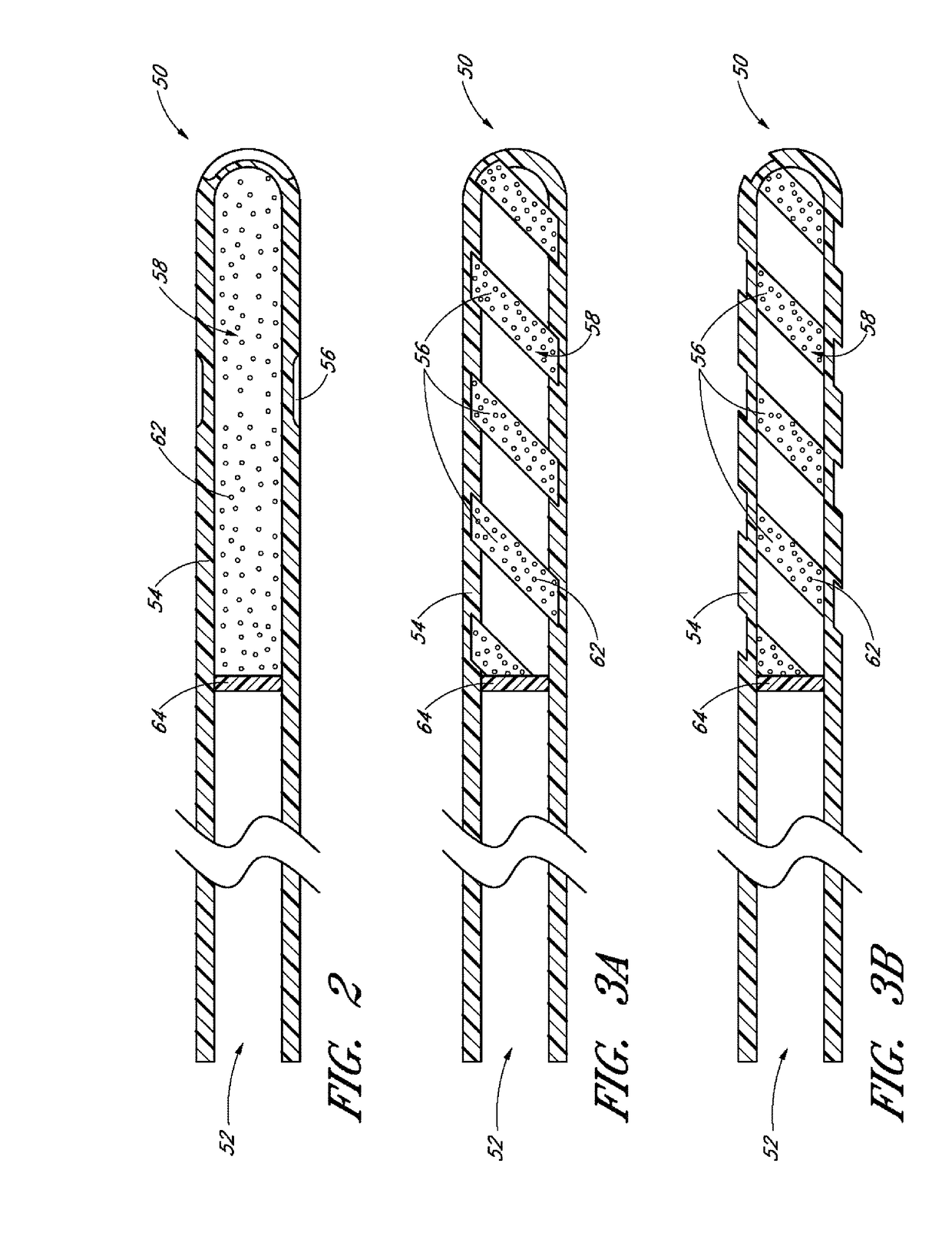 Implants with controlled drug delivery features and methods of using same