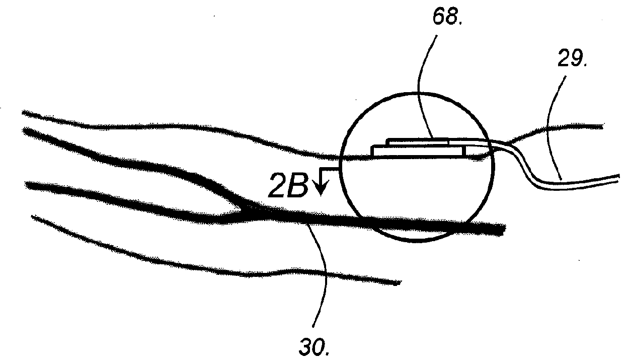 Continuous, non-invasive, optical blood pressure monitoring system