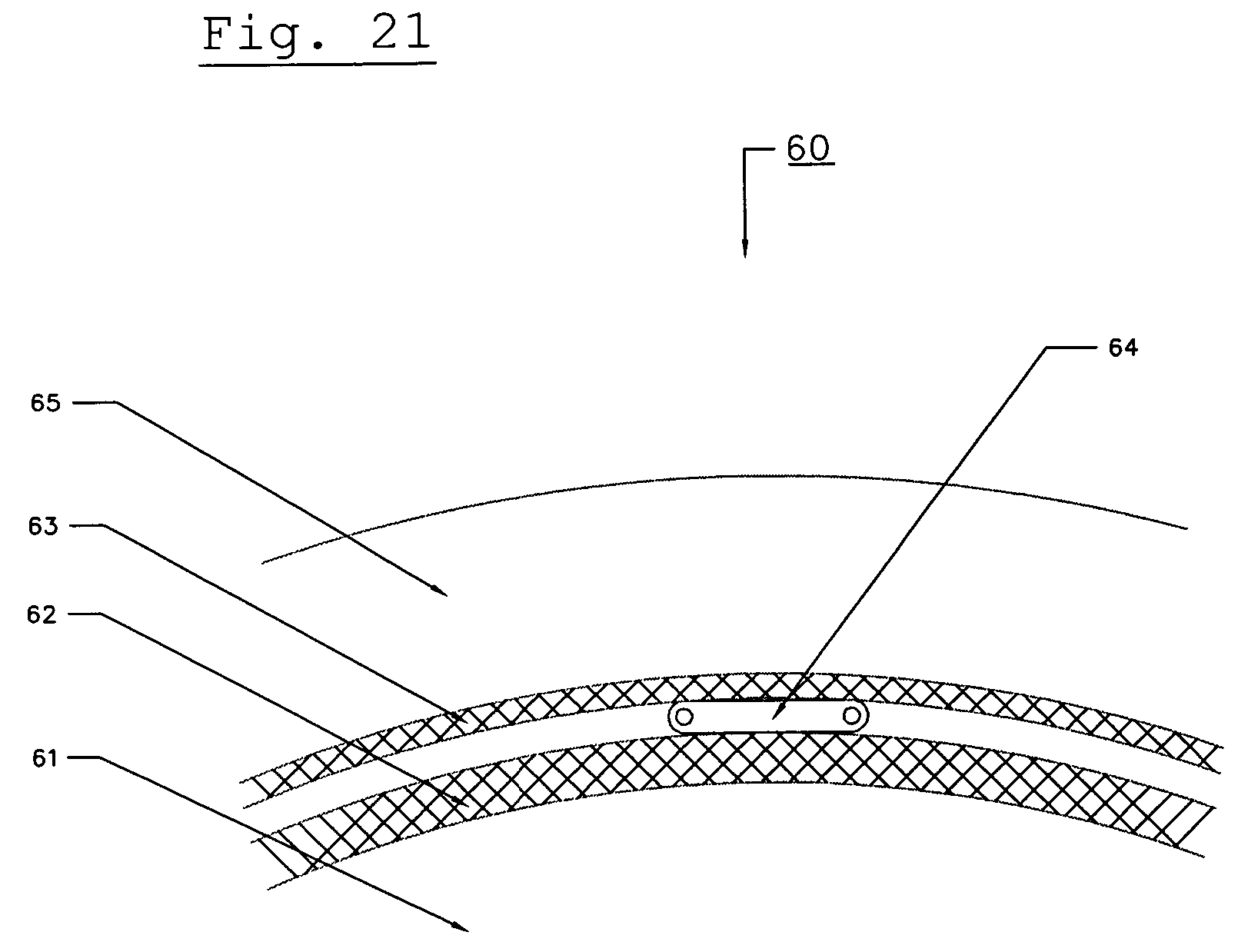 Underground electrical cable with temperature sensing means