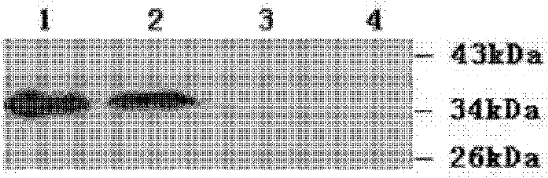 Clostridium difficile exotoxin A carboxy-terminal gene sequence with optimized codon and nucleic acid vaccine thereof