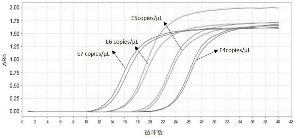 Human pulmonary infection assessment method based on intestinal flora in excrement sample and application of human pulmonary infection assessment method