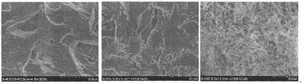 Chitosan hydrogel, and preparation method and application thereof