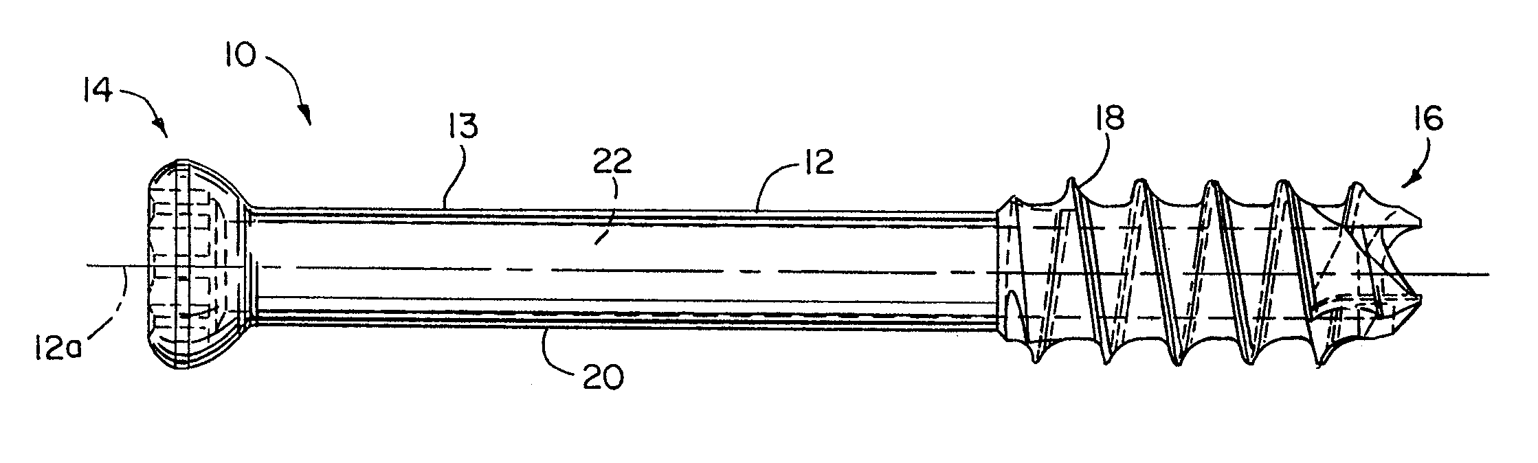 Cannulated Bone Screw