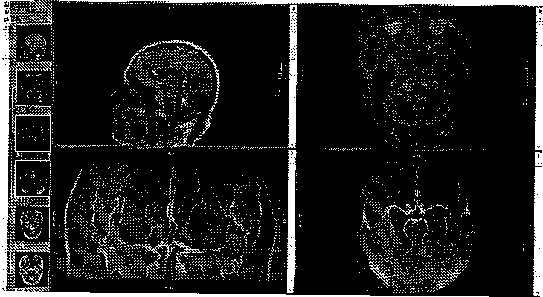 Medical image system pathfinder implementing method based on thumbnail