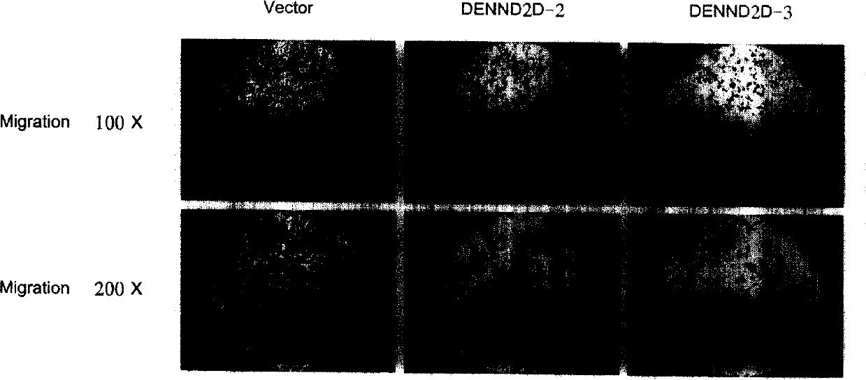 Tumor correlated albumen, coding gene and application thereof