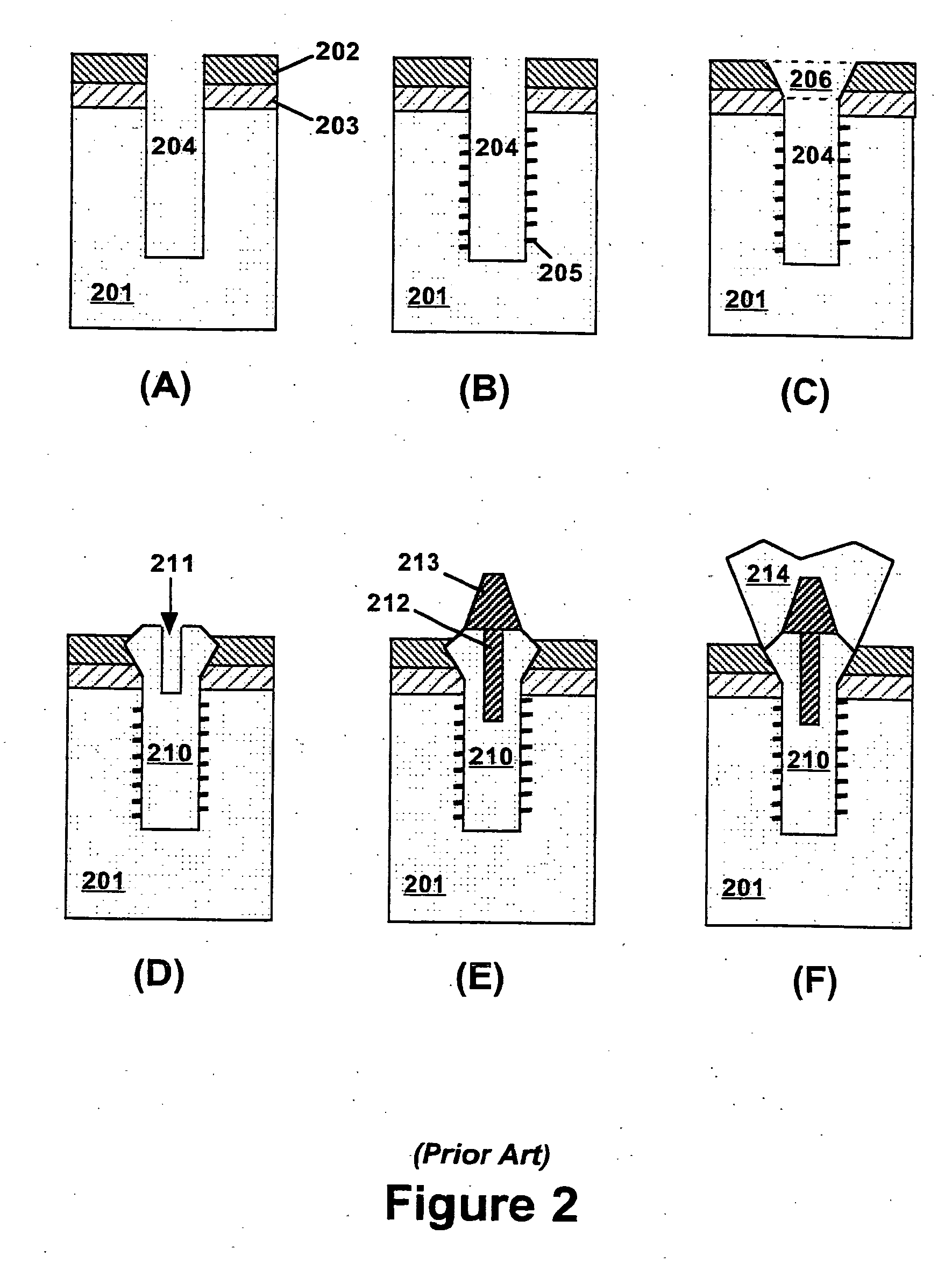 Method for vertical positioning of dental implants