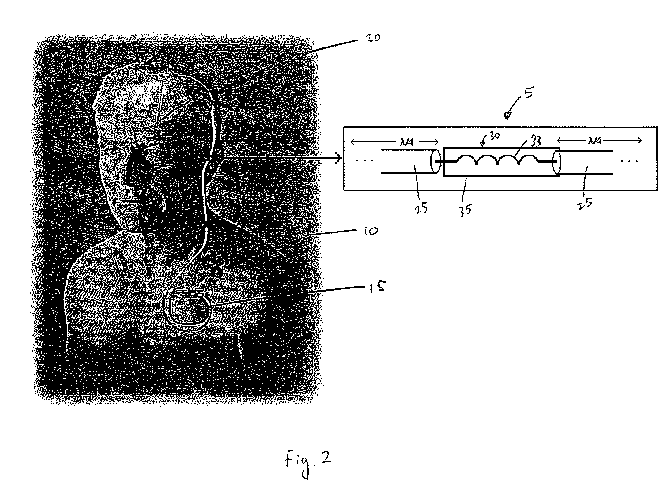 Electrical lead for an electronic device such as an implantable device