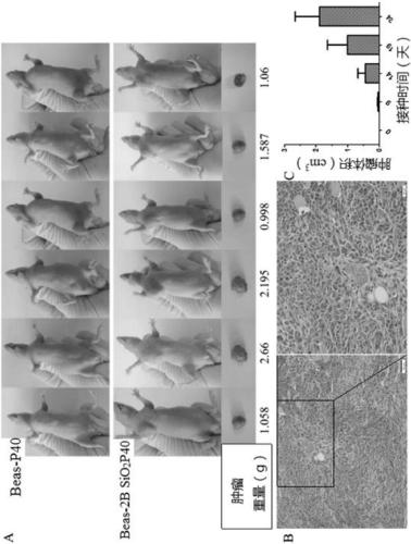 Model cell strain for malignant transformation of lung cell induced by nano-silica dioxide and application thereof