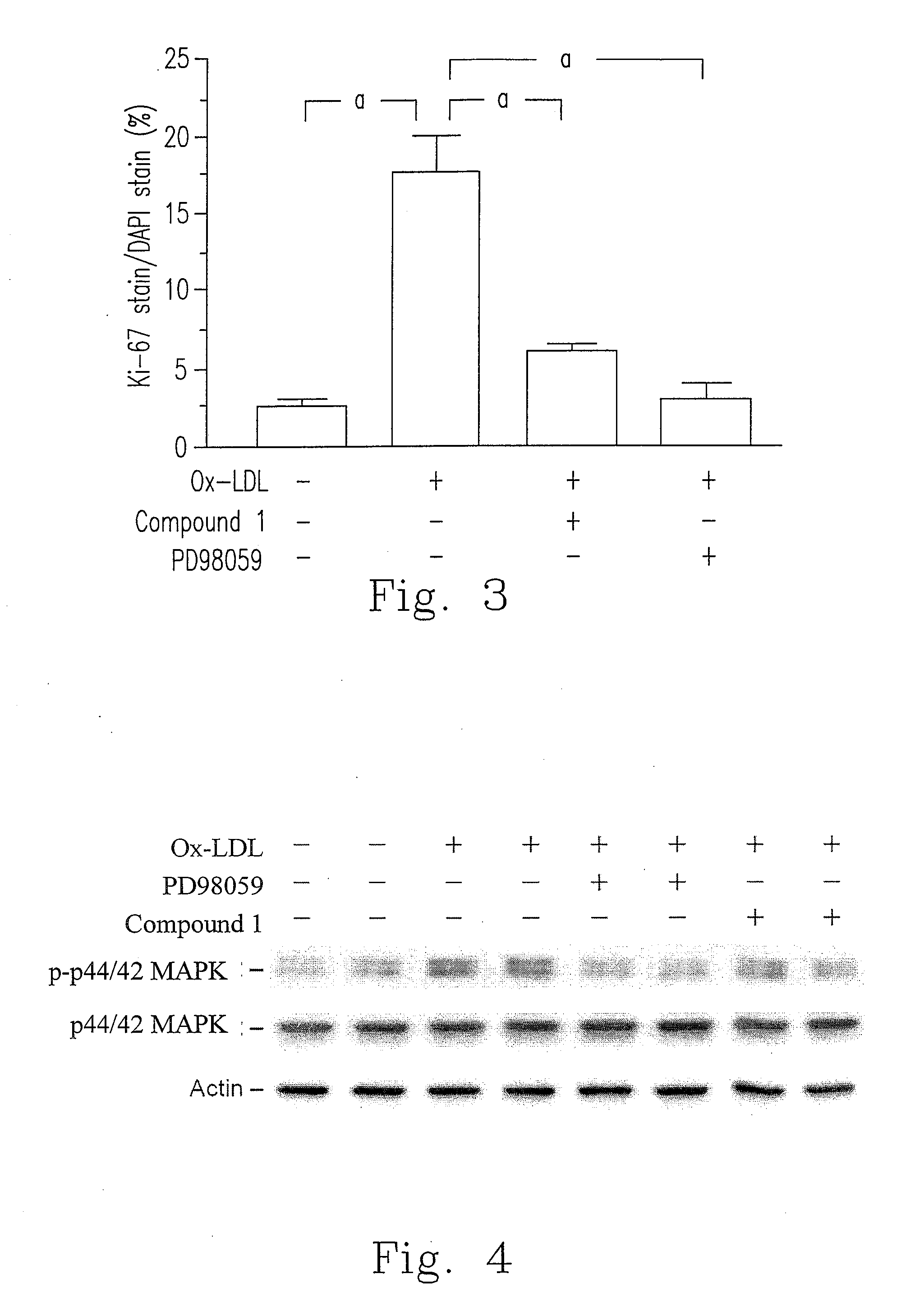 Composition for treating atherosclerosis and a preparation method thereof