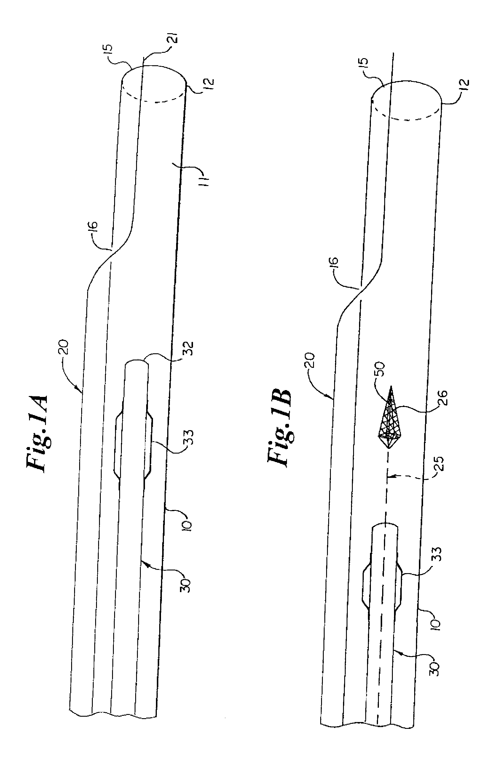 Rapid exchange sheath for deployment of medical devices and methods of use