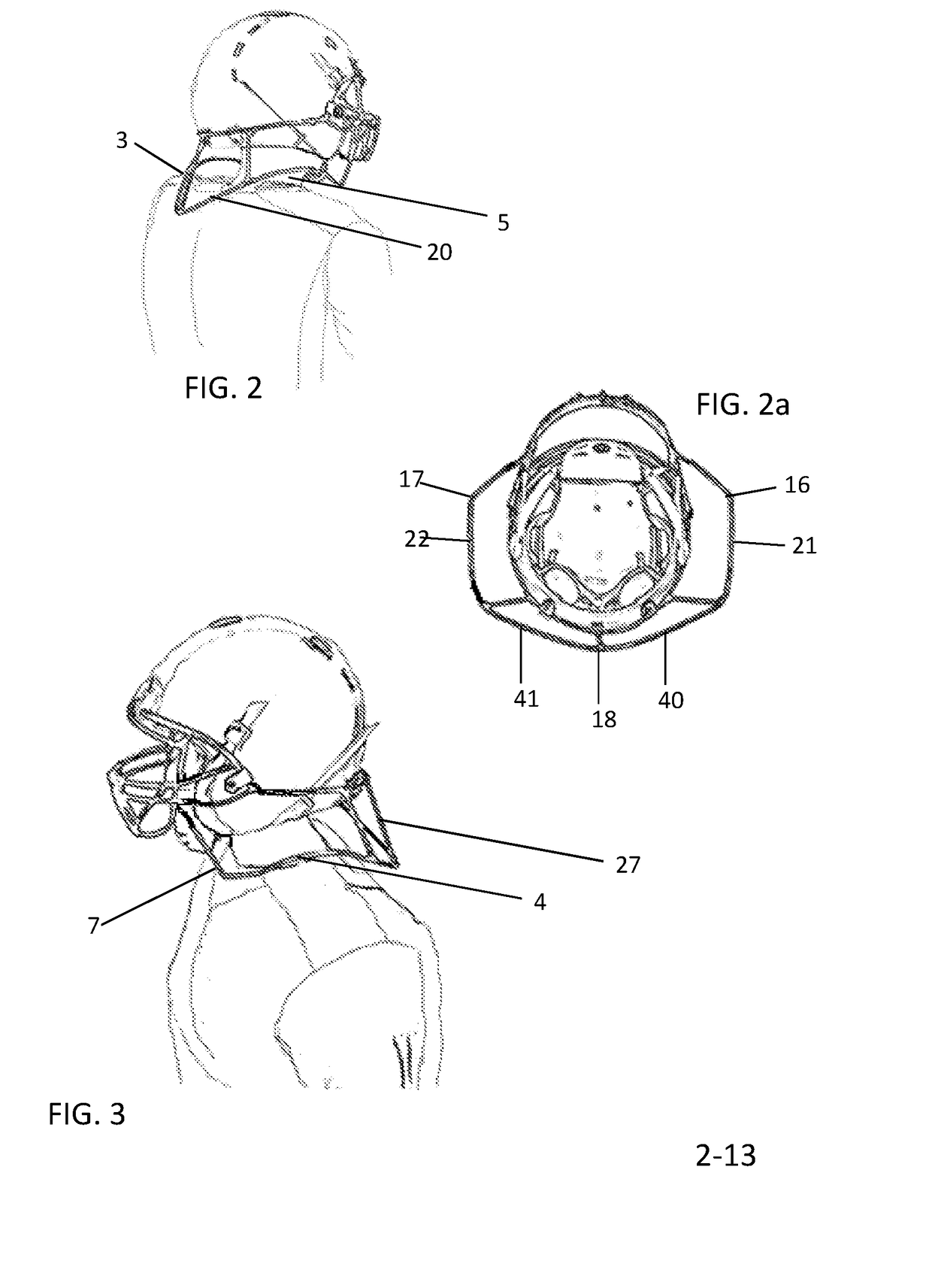 Concussive Reduction Helmet Attachment(s) Translational Axial Rotation Control and Bracing System (TARCBS).