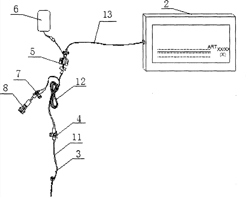 Puncture method of artery puncture needle for invasive arterial blood pressure monitoring