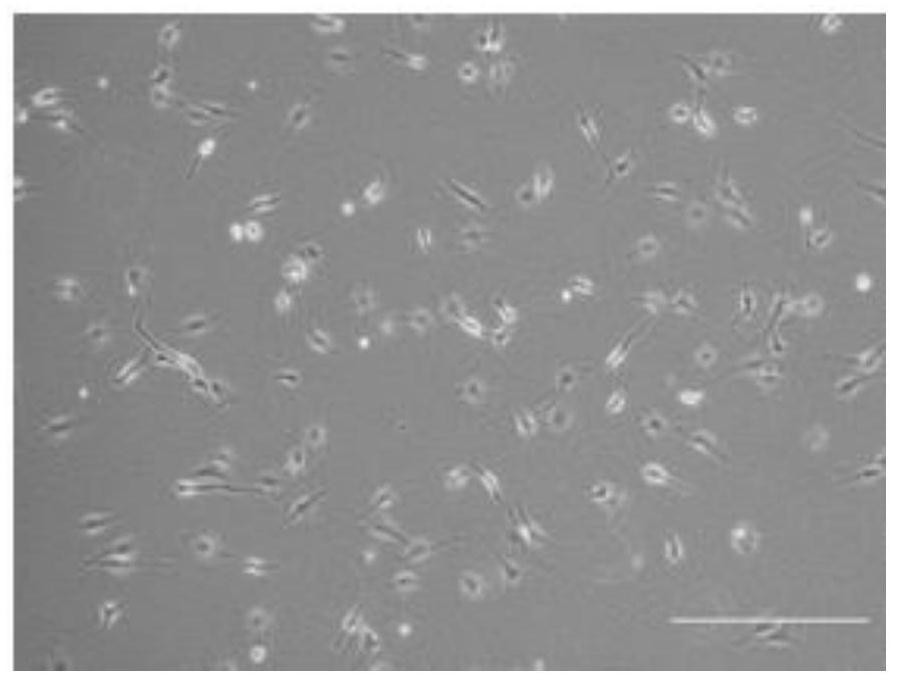 Primary tumor cell culture medium, culture method and application