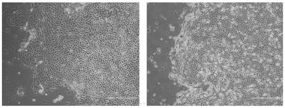 Primary tumor cell culture medium, culture method and application