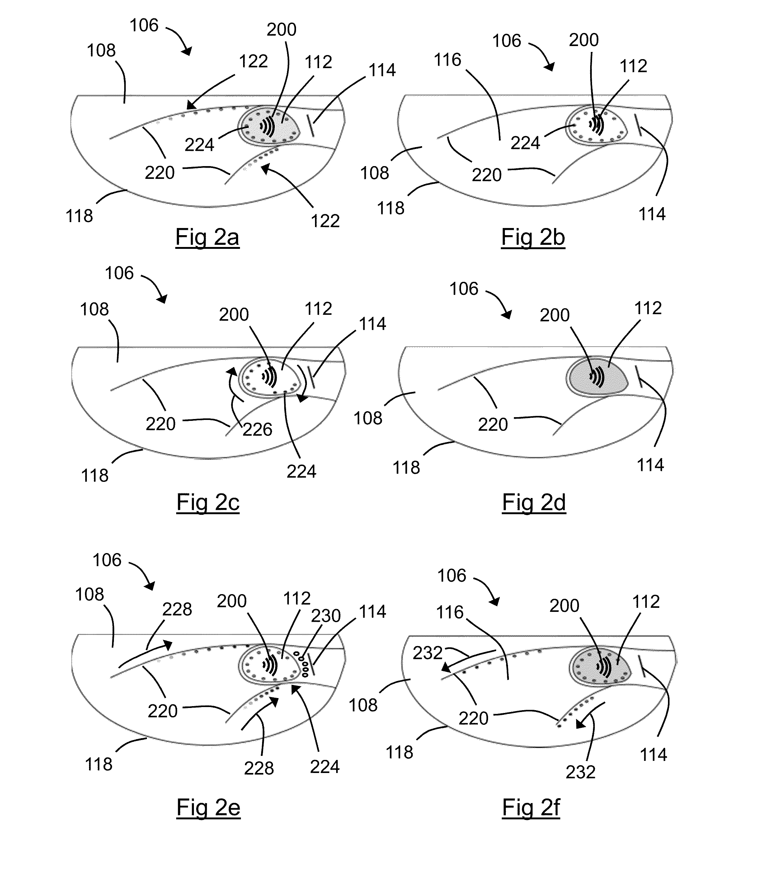 User inerface for an sst