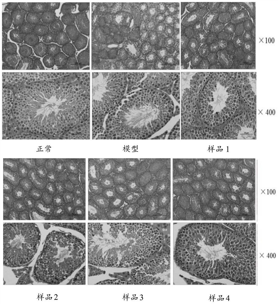 Traditional Chinese medicine compound composition with effect of improving male sexual function and application of traditional Chinese medicine compound composition