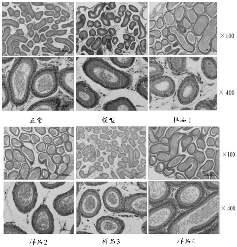 Traditional Chinese medicine compound composition with effect of improving male sexual function and application of traditional Chinese medicine compound composition