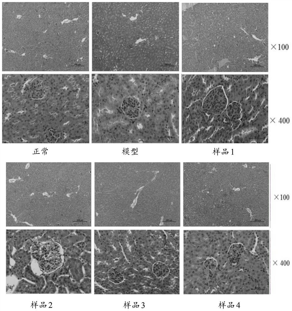 Traditional Chinese medicine compound composition with effect of improving male sexual function and application of traditional Chinese medicine compound composition