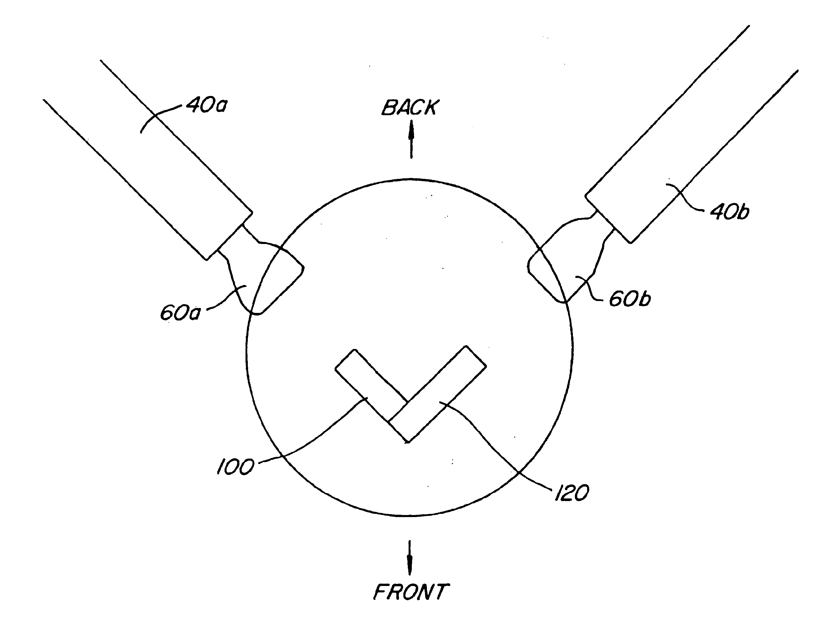 Bone blocks and methods for inserting bone blocks into intervertebral spaces