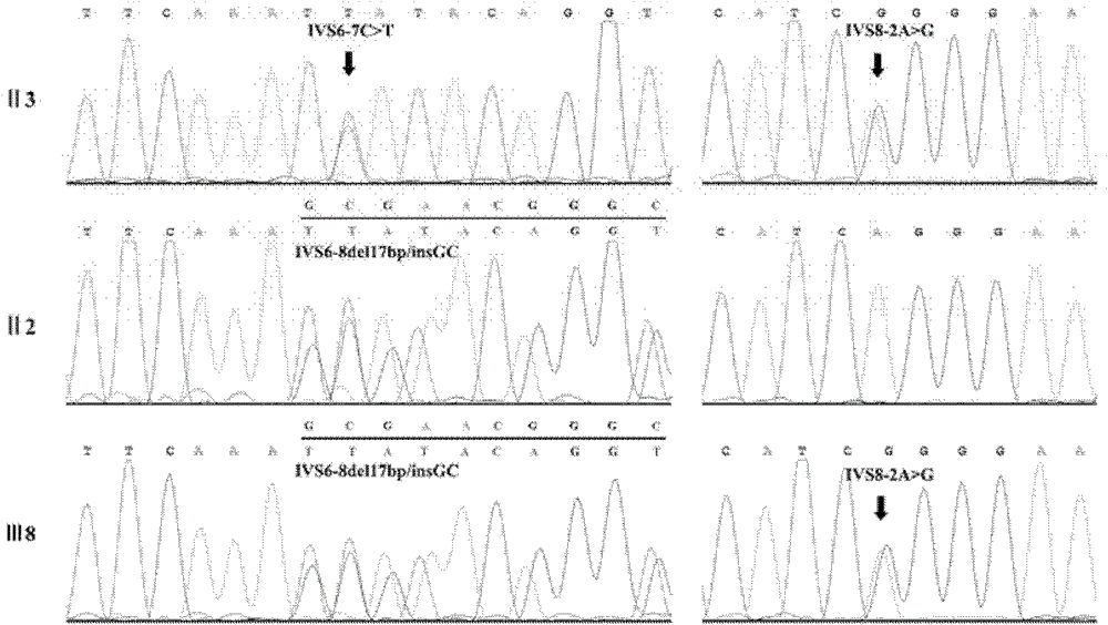 Retinitis pigmentosa related gene identification, and product, method and use thereof