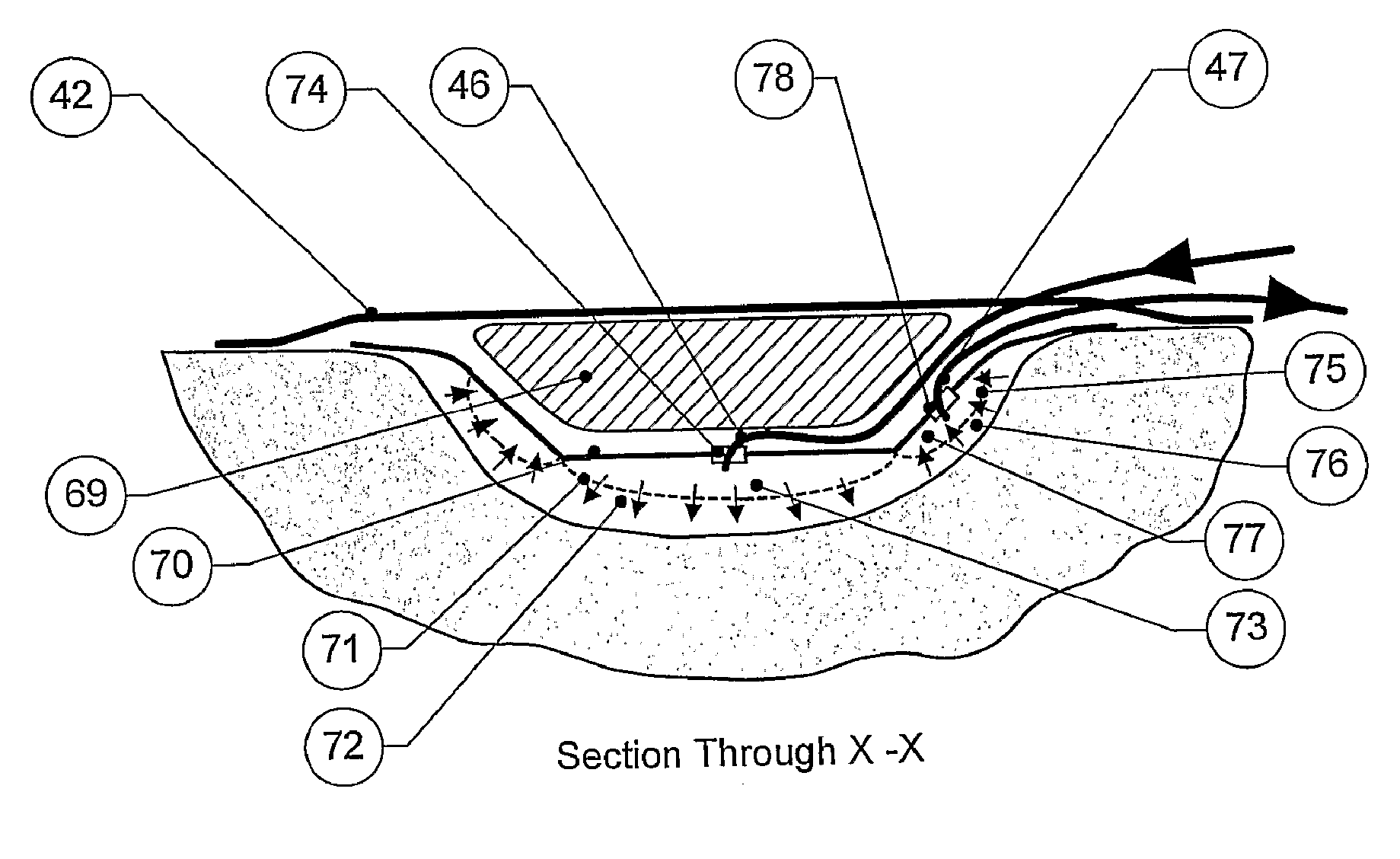 Wound dressing apparatus and method of use