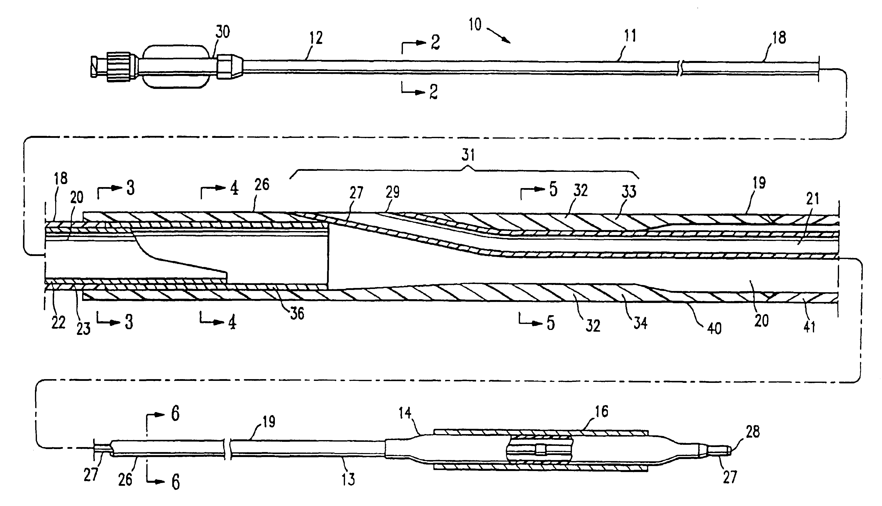 Catheter having improved rapid exchange junction