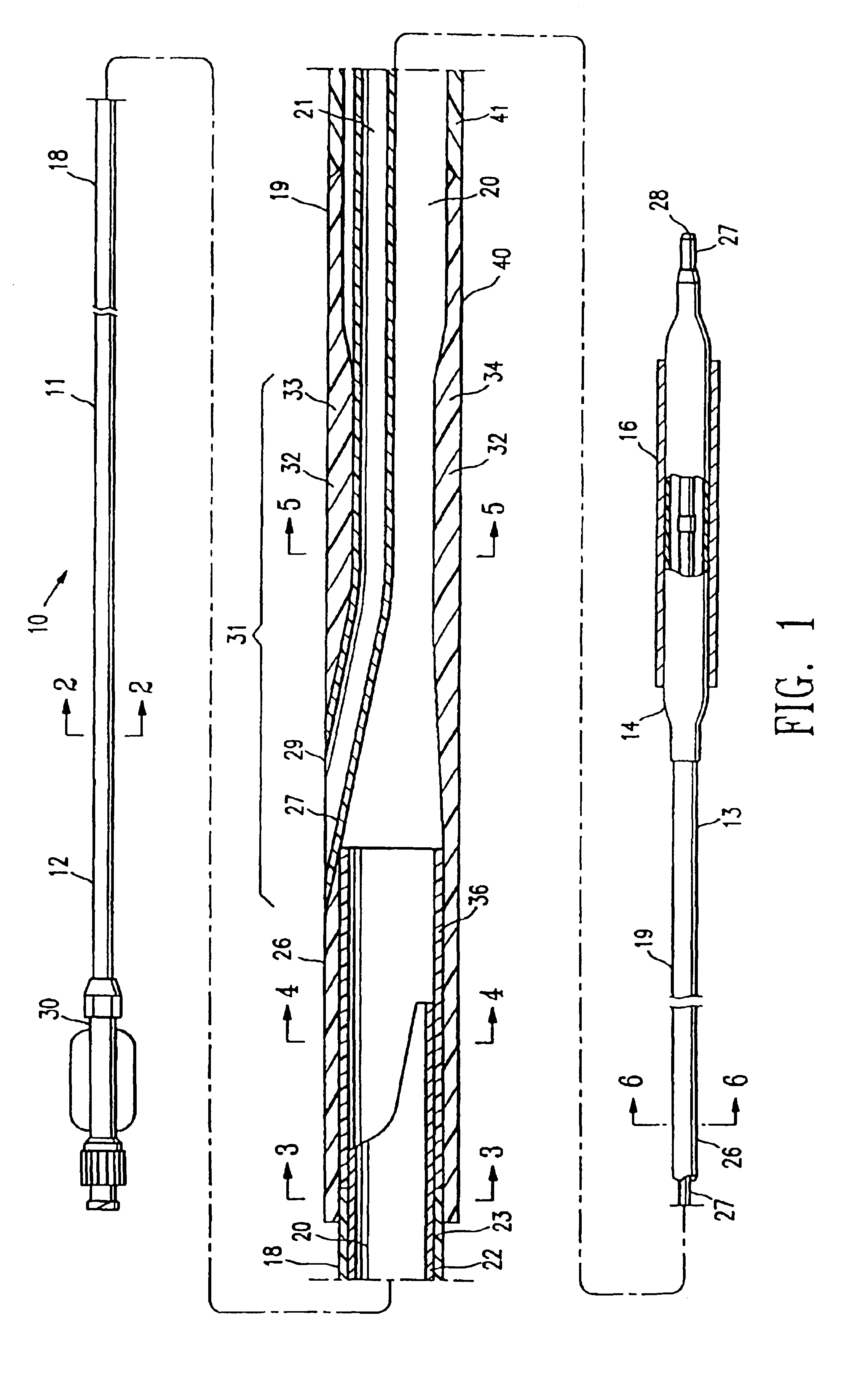 Catheter having improved rapid exchange junction