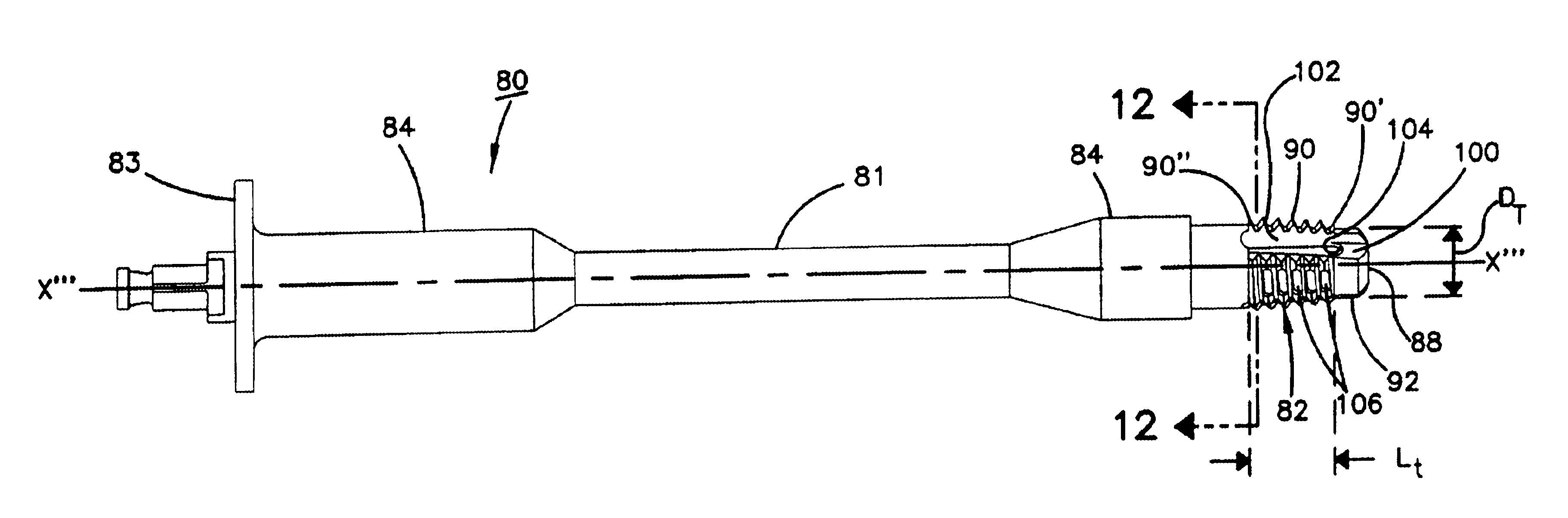 Lordotic spinal implant