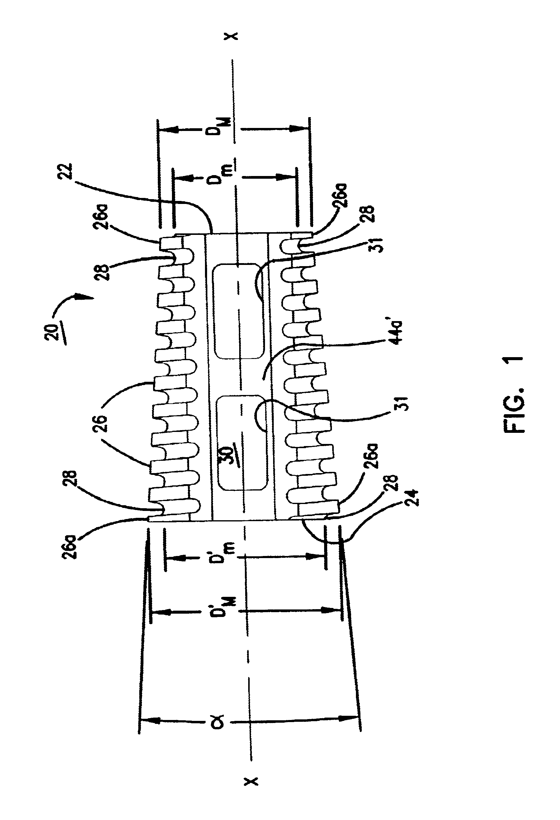 Lordotic spinal implant