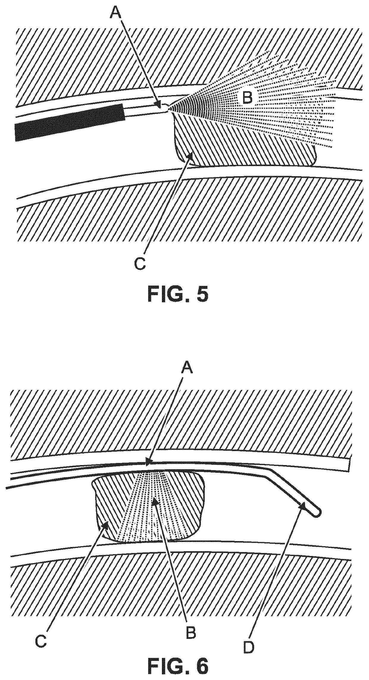 Intravascular optical device