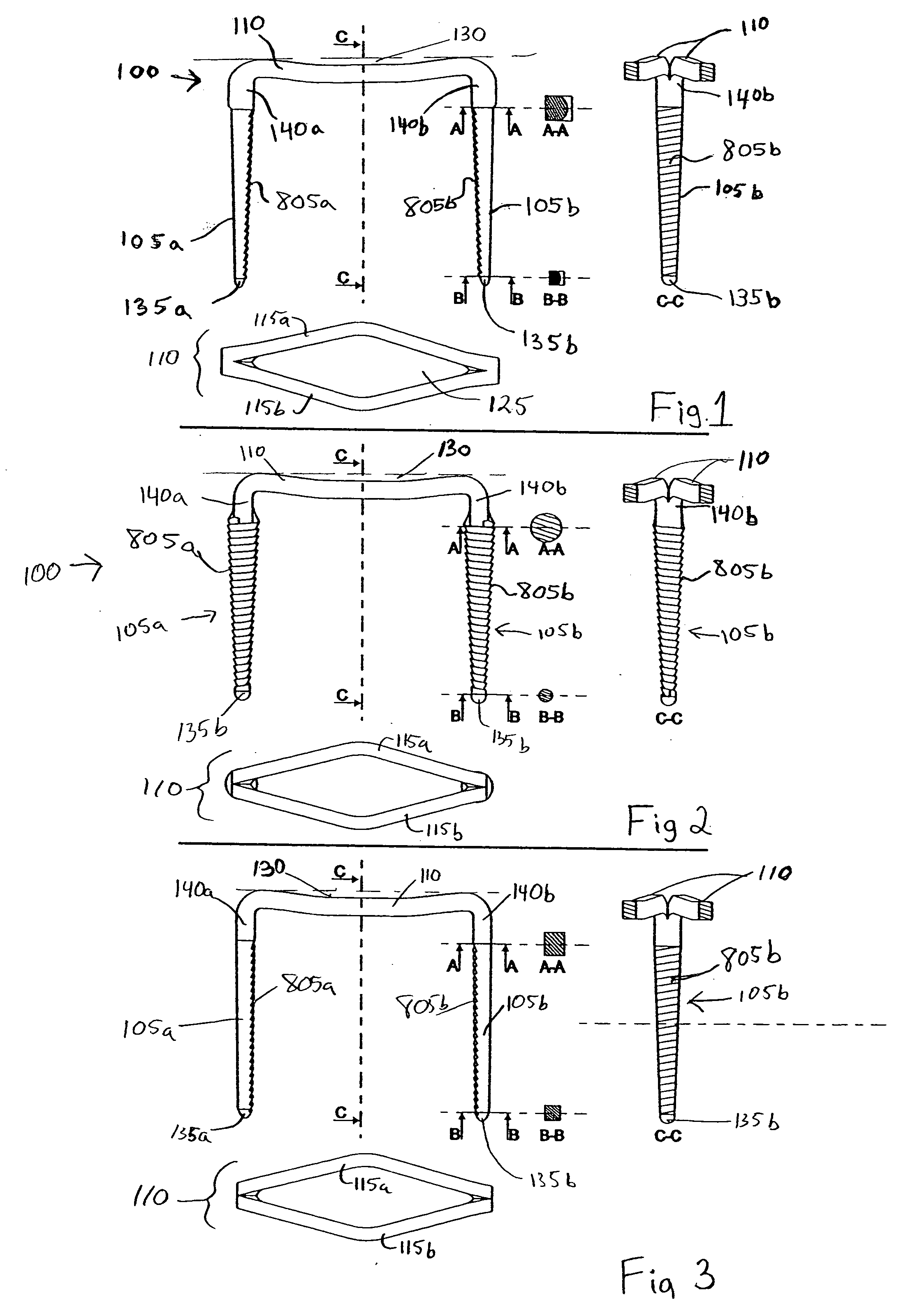 Osteosynthesis clip and insertion tool for inserting an osteosynthesis clip into bone tissue fragments