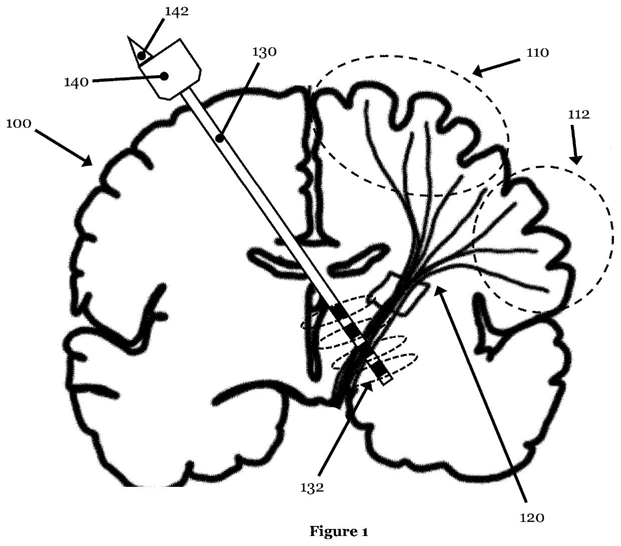 Neuronal communication system