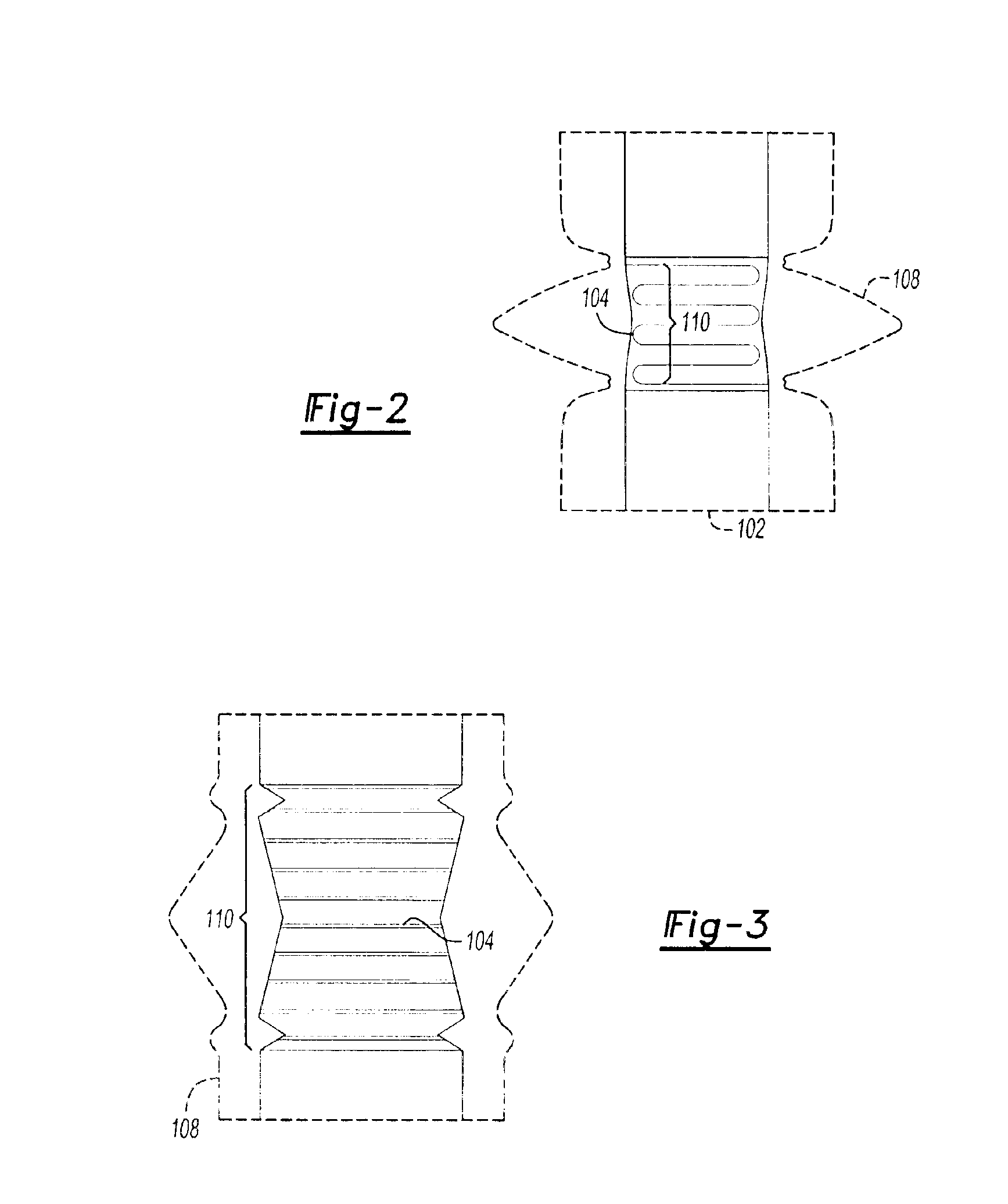 Torque sensor with contoured magnetoelastic element