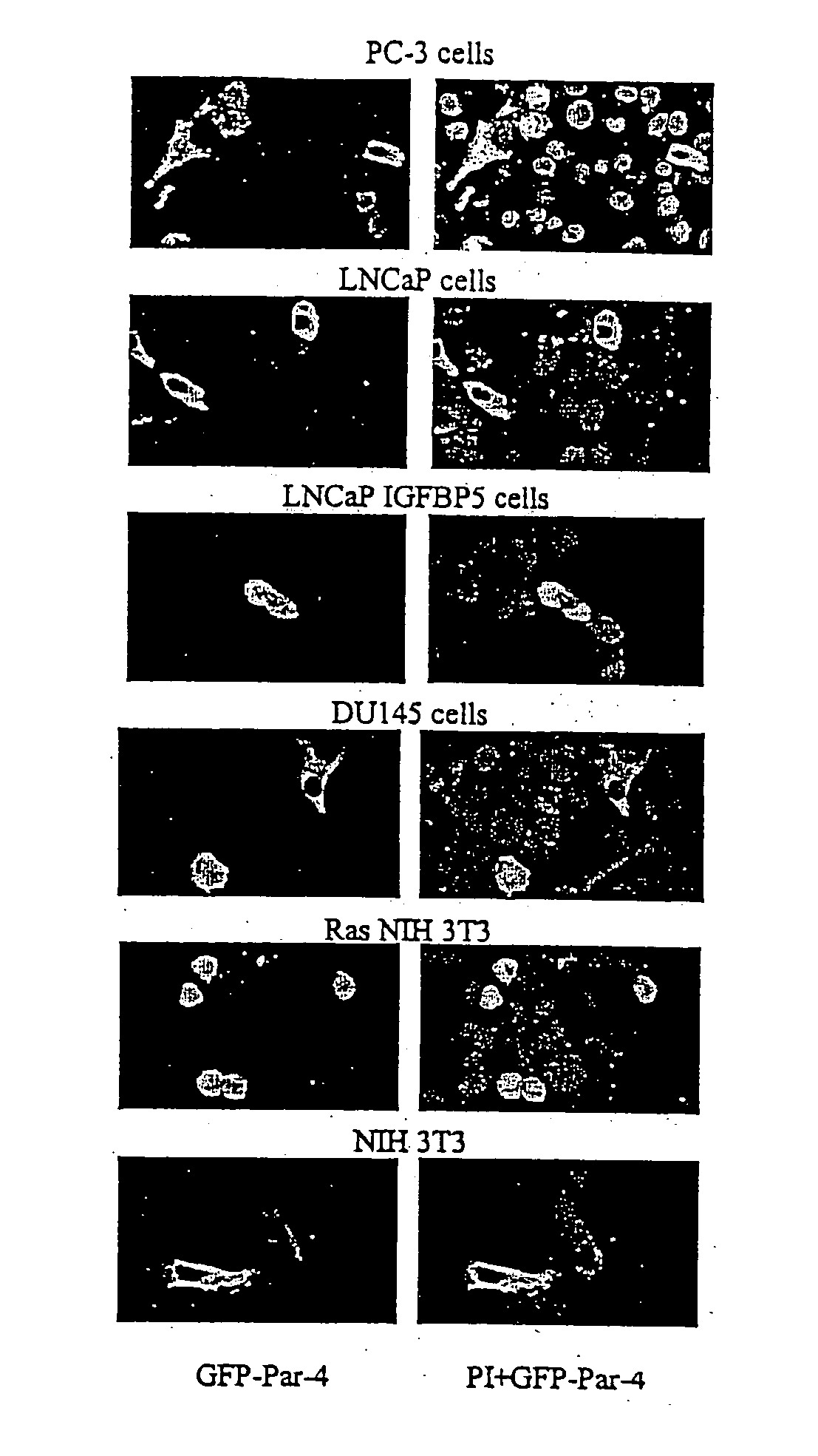 Identification of a unique core domain of Par-4 sufficient for selective apoptosis induction in cancer cells