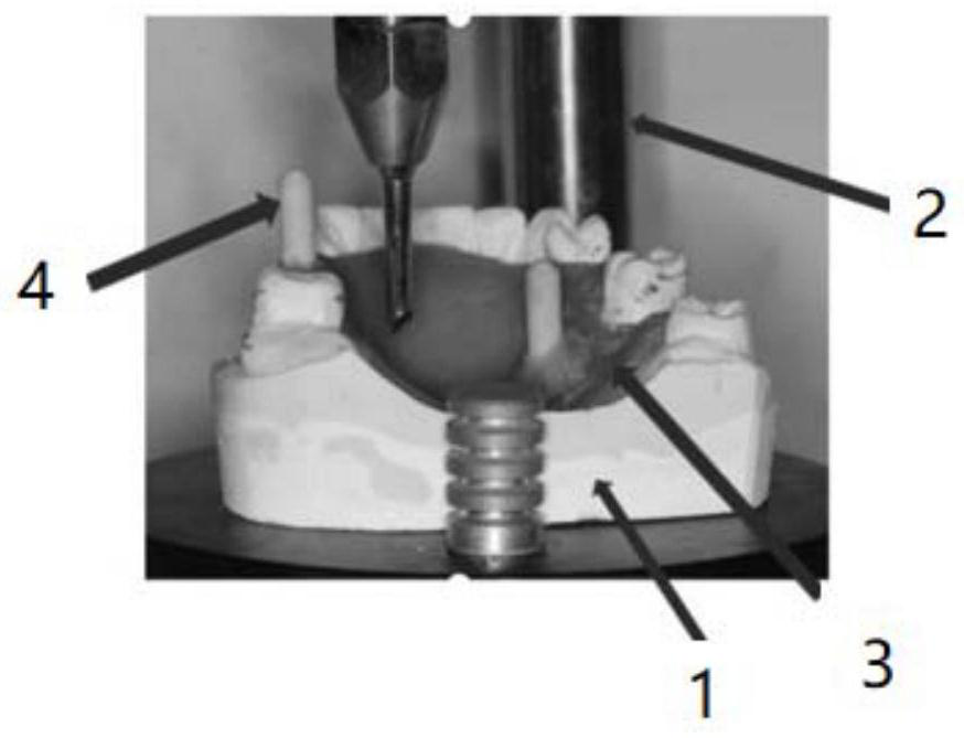 Digital transfer method and digital transfer system for partial removable denture common insertion path